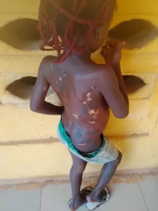 Police arrest mother for burning daughter with hot knife over stolen meat