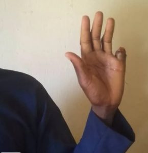 Man cuts off own finger over N80m ‘occult deal’