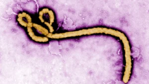 No Ebola Case in Oyo — Commissioner